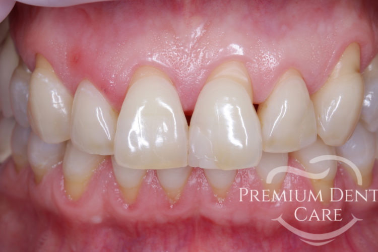 Premium Dental Care Praha