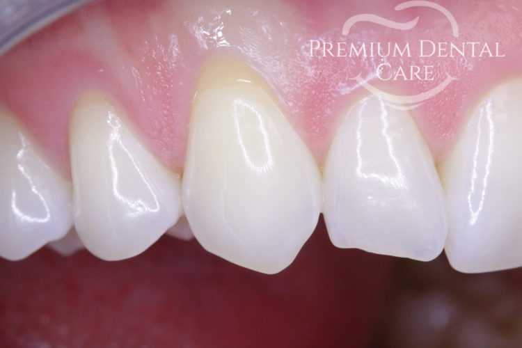 Premium Dental Care Praha