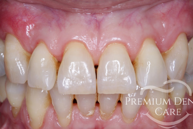 Premium Dental Care Praha