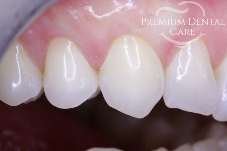 Premium Dental Care Praha