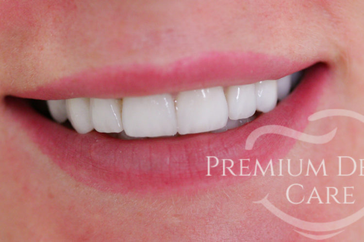 Premium Dental Care Praha