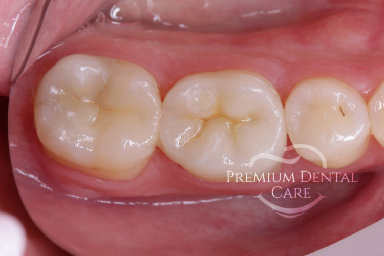 Premium Dental Care Praha