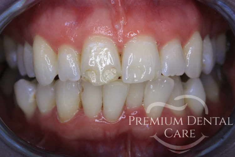 Premium Dental Care Praha