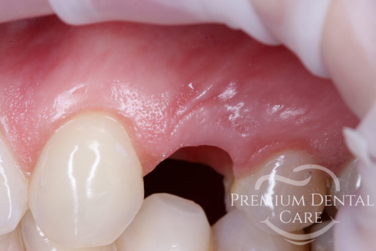 Premium Dental Care Praha