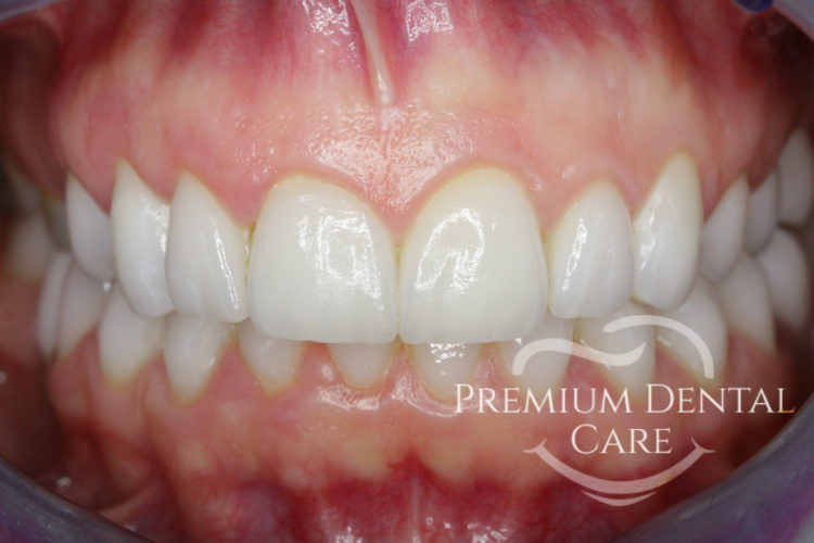 Premium Dental Care Praha