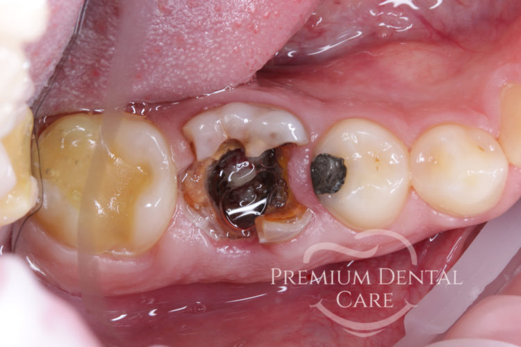 Premium Dental Care Praha