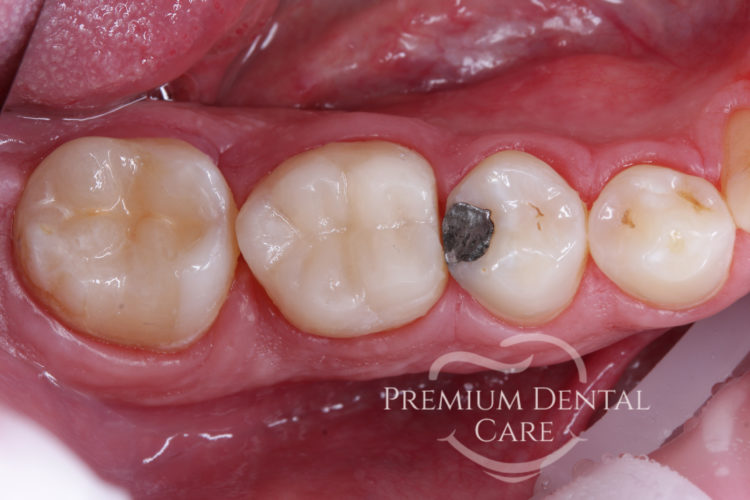 Premium Dental Care Praha