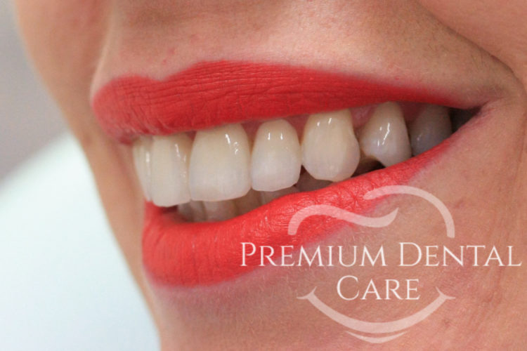 Premium Dental Care Praha