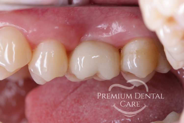 Premium Dental Care Praha