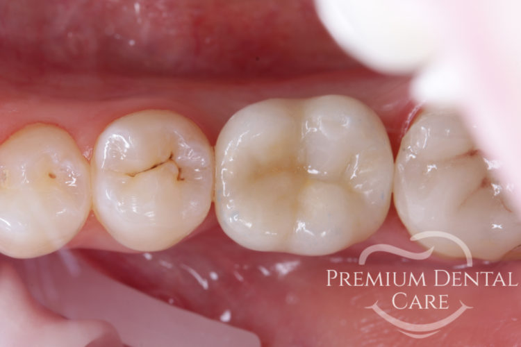 Premium Dental Care Praha