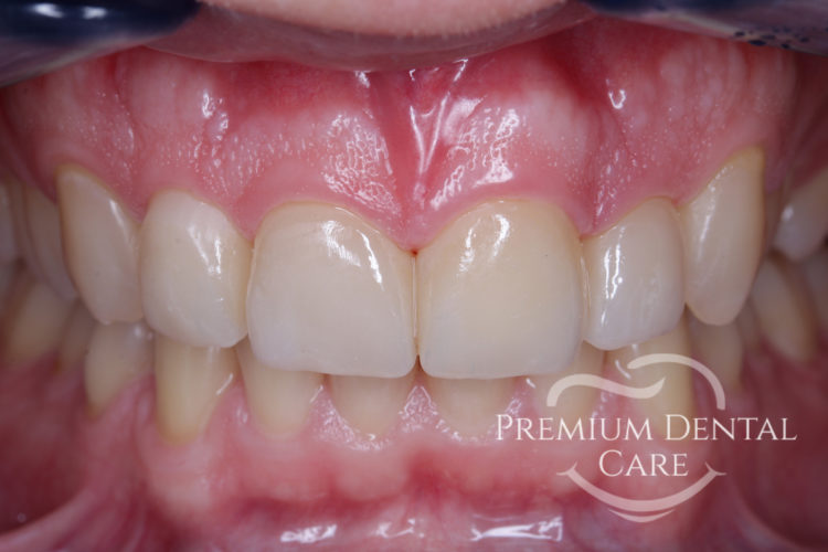 Premium Dental Care Praha