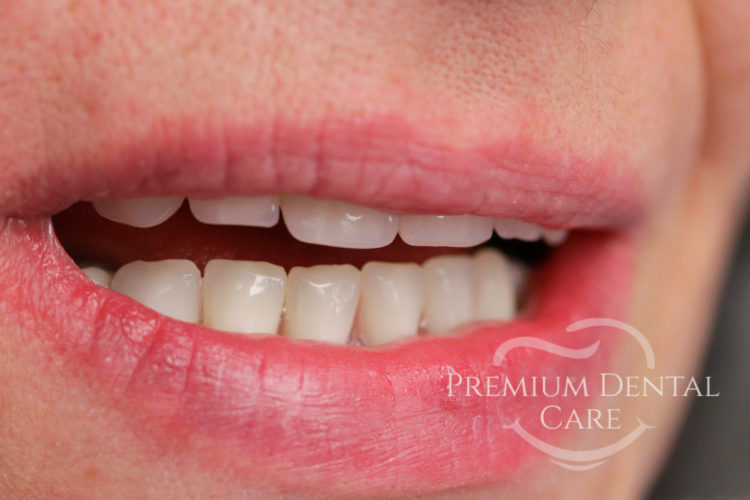 Premium Dental Care Praha