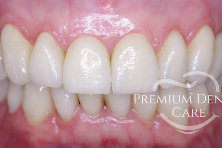 Premium Dental Care Praha