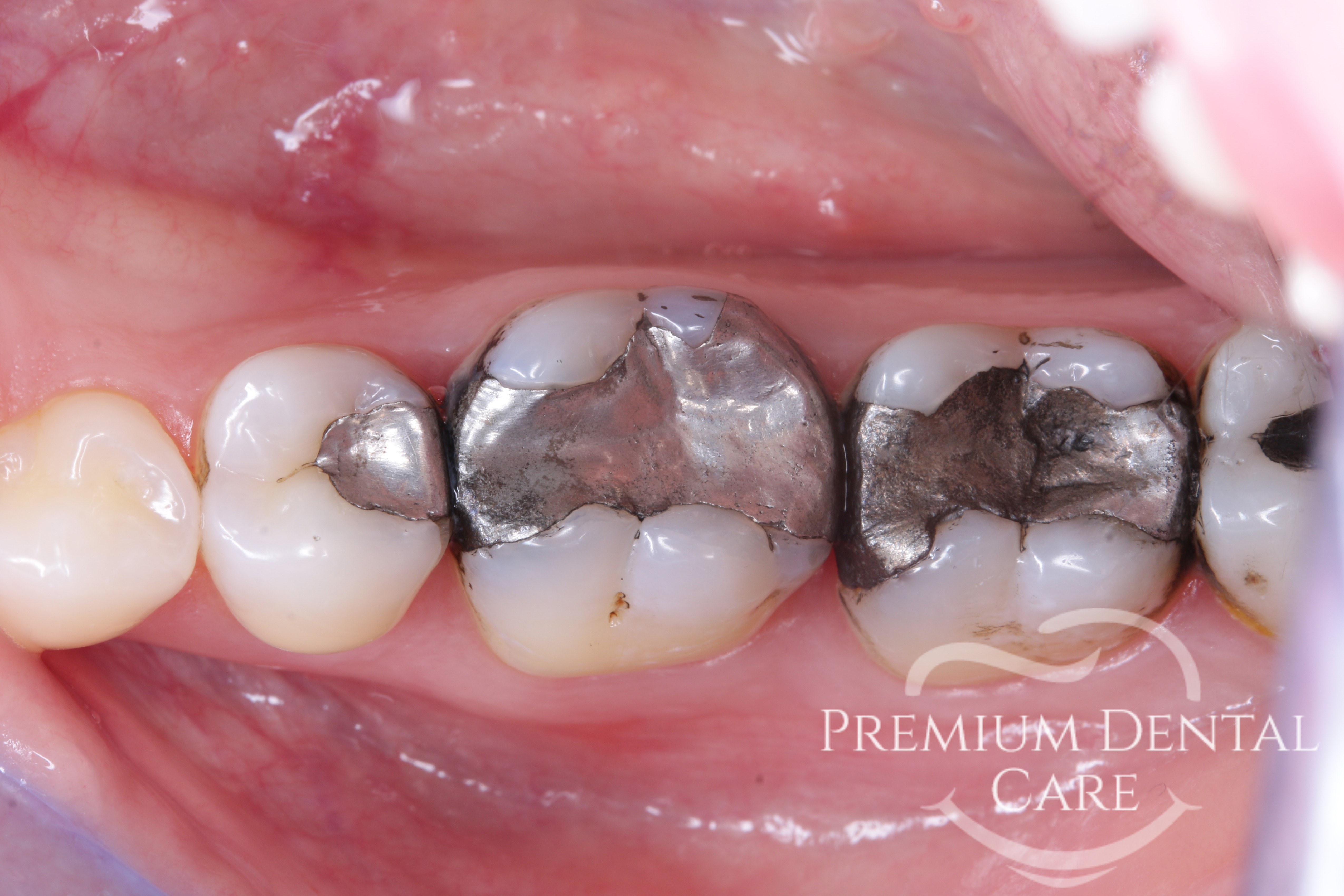 Premium Dental Care Praha