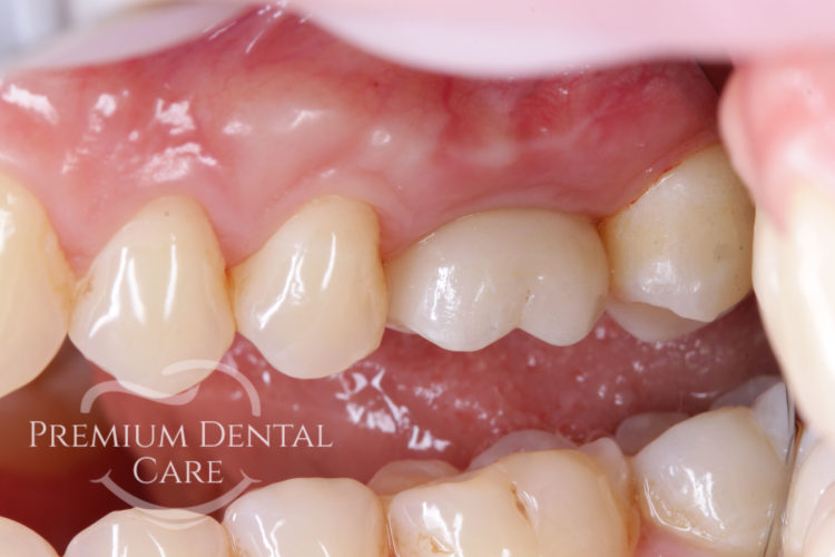 Premium Dental Care Praha